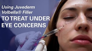 Known for its noteworthy track record for providing effective lasting results in filling the skin or augmenting the lips, Juvéderm® is one of our most popular dermal fillers that we provide. At the ZO Skin Centre® Beverly Hills, CA, our team focuses on your needs, skin, and aesthetic goals to improve hollow areas on the face where additional contour and volume is desired. The hyaluronic acid in Juvéderm® will stimulate your natural production of collagen and elastin to enhance your skin's tone. 