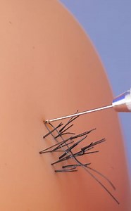 Amazing Medical Tricks and Surgery Secrets Revealed | Health is Wealth