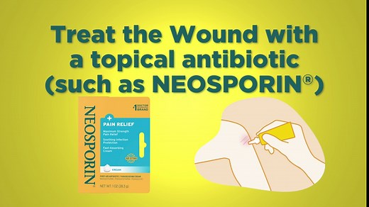 Neosporin + Pain Relief Neo to Go! First Aid Antiseptic/Pain Relieving Spray,.26 Oz