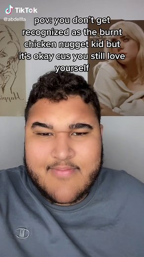 Embracing My Burnt Chicken Nugget Aesthetic