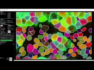 Cellpose2: human-in-the-loop model training (2x speed)