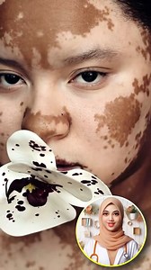 890K views · 9.1K reactions | না জানলে অনেক বড় ভুল করবেন | Health Tips & Tricks by Oishi | Facebook