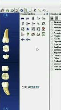 Customizing Procedure Buttons in Dentrix #dentrix #dentistry #dentalhygienist #dentalassistant