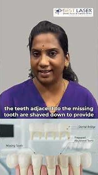 Best Way to Replace Missing Teeth | Dental Implants Explained