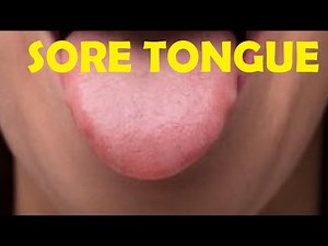 How to Heal Your Tongue After Eating Sour Candy