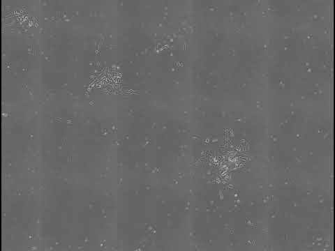 血液の細胞からiPS細胞ができてくる様子/Reprogramming to iPSCs from human blood cells.