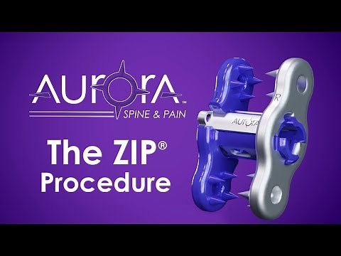 The ZIP® Procedure - Medical Animation