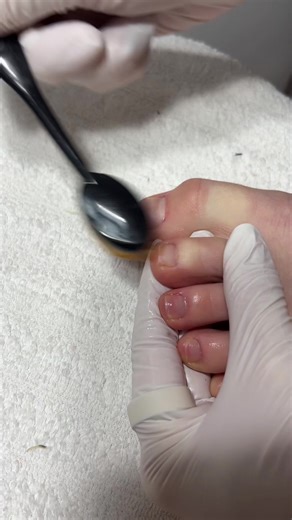 TRUST the process…. I almost didn’t post this one😆 Speed gel pedicure prep on myself, part 1🤍 (I can’t believe I’m actually showing you the state I left these in, but it’s completely my own fault for leaving it sooo long) #pedicure #gelpedi #gelpedicure #toes #geltoes