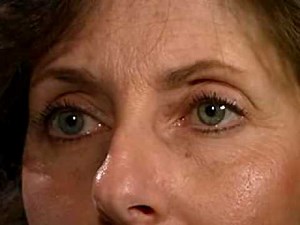 Neurologic Exam Cranial Nerves Normal : Smooth Pursuit