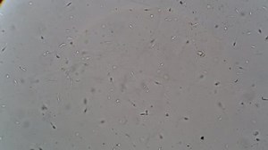 Semen Seminal Fluid Human Under Microscope Stock Footage Video (100% Royalty-free) 1010642291 | Shutterstock