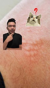 5K views · 20 reactions | Red, itchy, or flaky skin out of nowhere? ...