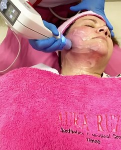 19K views · 84 reactions | EXILIS ULTRA 360 PROMO 1+1 sessions 4800...