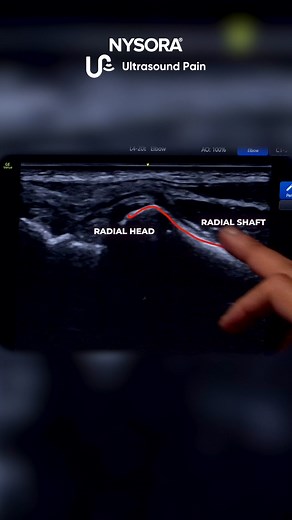 2.4K views · 12 reactions | A 45-year-old patient presents with pain...