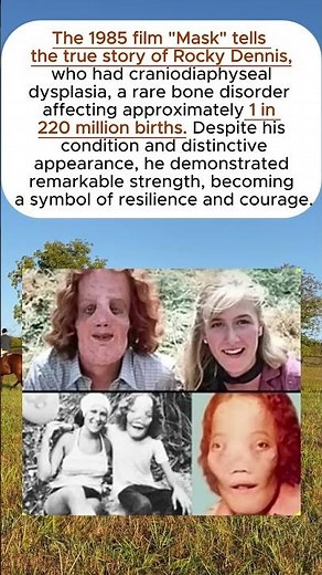 The 1985 film "Mask" tells the true story of Rocky Dennis