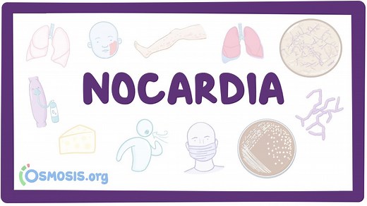 Nocardia: Video, Causes, & Meaning | Osmosis