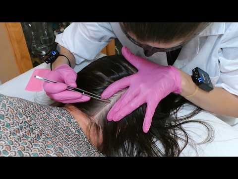 ASMR School Nurse LICE Check on Scalp and Neck | Lice Removal with a Comb and Tweezers (Real Person)