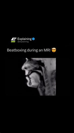 Explaining | Follow (us) @Explaining to learn something NEW every day 🧠‼️ This experiment had a guy beatbox during an MRI — and the scan captured the... | Instagram