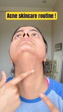 After *GYM* Skincare for Hormonal Acne #skincare #shorts