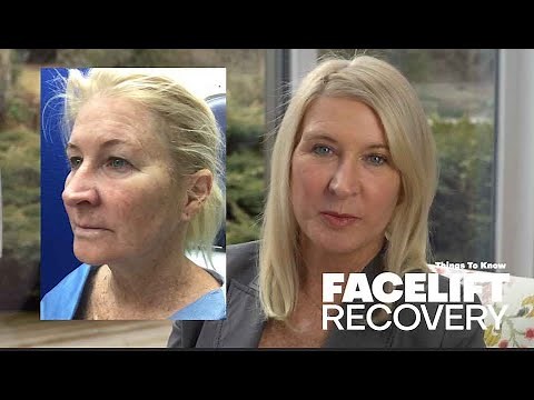 My Facelift Recovery - What To Expect - Things To Know - Pain? Timeline?