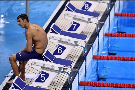 Why does Michael Phelps do Cupping? Real reason explored