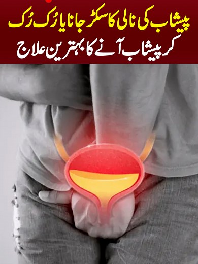 Understanding Stricture Urethra: Causes, Symptoms & Treatment Explained by Dr Usama Nawaz Ghumman
