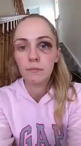 11K views · 377 reactions | domestic violence against women is a huge problem among us! Let's just hope more women out there who face similar situations open up, this lady Emma Murphy is very brave & we can't imagine the trauma it has brought to her.. This video is an inspiration! | Welcome to Ireland. | Facebook