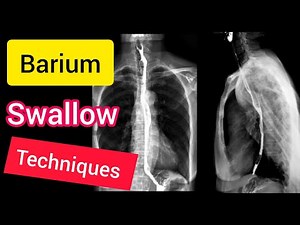 Barium Swallow Contrast X-ray technique explained English |