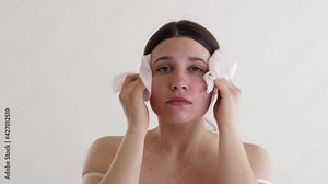 Woman Wipes Face With Wet Wipes. Washes Face In The Morning From The Mask. Face With Acne. Cosmetology.