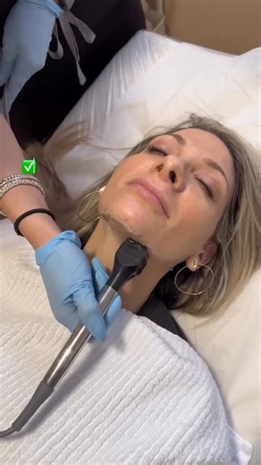 InMode Middle East | Effortless precision meets advanced RF technology. 🌟 #Forma delivers targeted skin tightening and collagen stimulation with comfort and... | Instagram