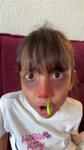 Let's go to the doctor Esther #izadoralima
