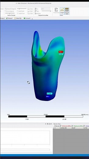 ANSYS WORKBENCH-static structural-socket under loading #biomechanics#ansys #solidworks #simulation