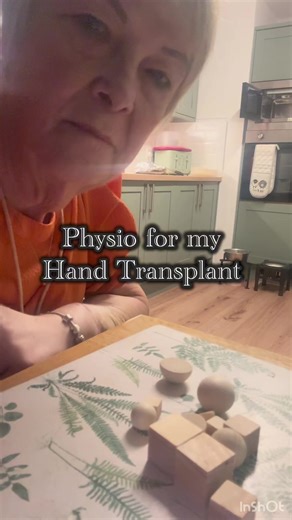 Physio Recovery After Hand Transplant