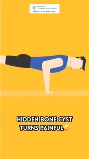 Hidden Bone Cyst Turns Painful 😳