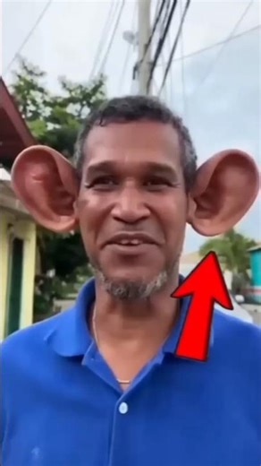 biggest ears in the world 😨