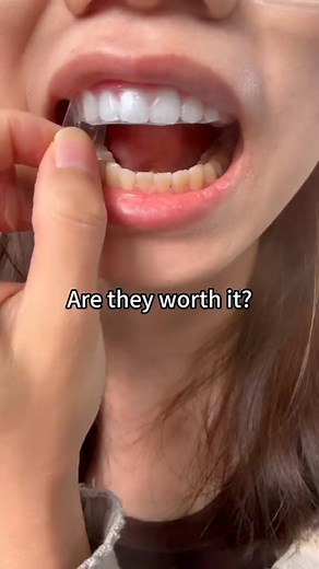 Yellow Teeth Savior! My teeth finally turn whiter in just 7 days!😲 ⬇️ Why thousands are switching to DrSmile: DRSMILE – Malaysia’s #1 Probiotic Whitening Toothpowder for yellow teeth, stains, bad breath & oral issues, trusted with 300,000 boxes sold. ✨ 4-in-1 Oral Solution: Whitens teeth, strengthens gums, reduces gum recession & freshens breath 🌿 Infused with 7 premium herbs & probiotics ✅ 100% Natural. No Chemicals 🏆 Awarded Asia Pacific Super Health Brand Smile brighter and healthier with 