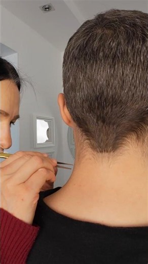 Skin treatment with tweezers