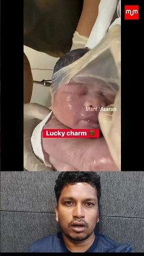 baby from operation theatre 👶