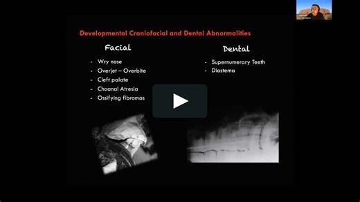 Webinar HDE - Developmental Facial and Dental Abnormalities in the Horse - Denis Verwilghen