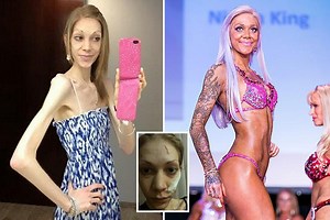 Anorexic waitress who weighed just 4st fought back to become a BODYBUILDER