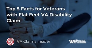 Top 5 Facts for Veterans with Flat Feet VA Disability Claim