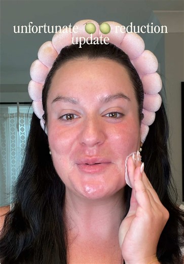 unfortunate #breastreduction update 🫪😩 #mastopexy #breastlift