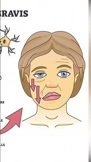Muscle Problems #science #anatomy #biology