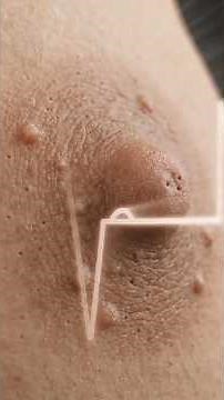 Inside the Female Breast | Real Anatomy Explained 🧠How Female Breasts Actually Work 🤯#BreastAnatomy