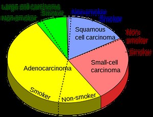 What Do You Know About Lung Cancer?