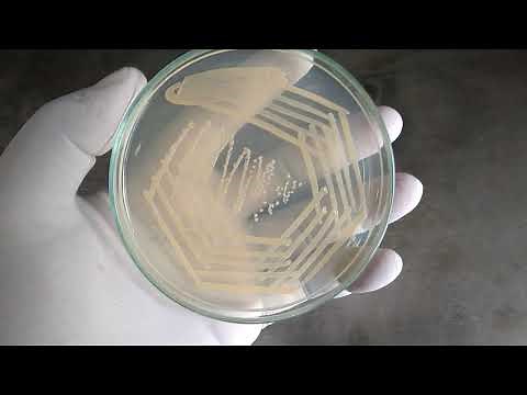Colony characteristics of Staphylococcus aureus on nutrient agar