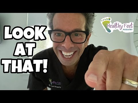 SURPRISED AND SHOCKED WHAT POPS OUT OF THIS FOOT!