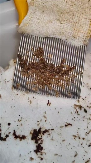 grosse infestation , 🧐#zantipoux #peigne #horror #poux