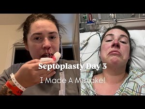 Septoplasty Recovery | Lots of pressure and pain, I had NO IDEA! After Deviated Septum Surgery