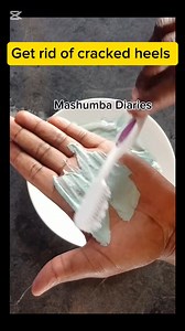 609K views · 1.5K reactions | Clear cracked heels in 7 days | MaShumba Diaries | Facebook