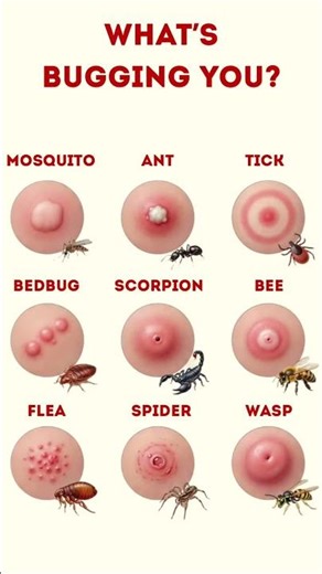 Can You Identify These Bug Bites?